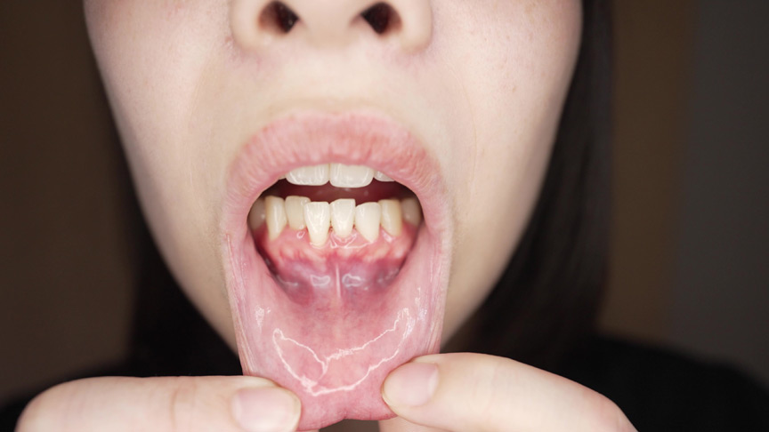 「【湊波流】【口腔フェチ】歯と舌の接写観察プレイ|変態紳士の匂いチェック動画【マニアック】」のサンプル画像3枚目