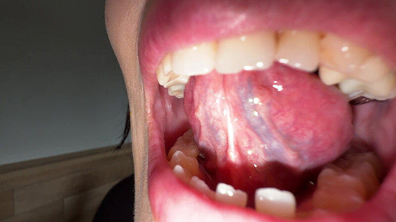 「【玉城夏帆】素人お姉さんをナンパ！舌ブラシで汚舌苔採取する個人撮影動画」のサンプル画像6枚目