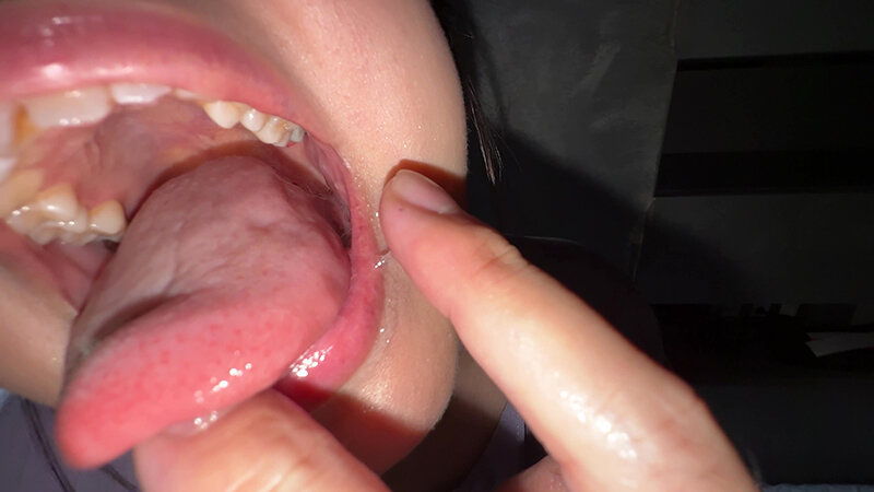 「【谷田かりな】素人お姉さんをナンパ！開口器で口内観察デカ舌チェック【個人撮影】」のサンプル画像17枚目