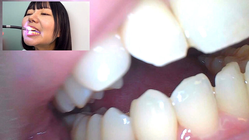 「【素人ナンパ】街角お姉さんみゆりちゃんの口内観察！テレビ局AD美女が恥じらい体験」のサンプル画像15枚目