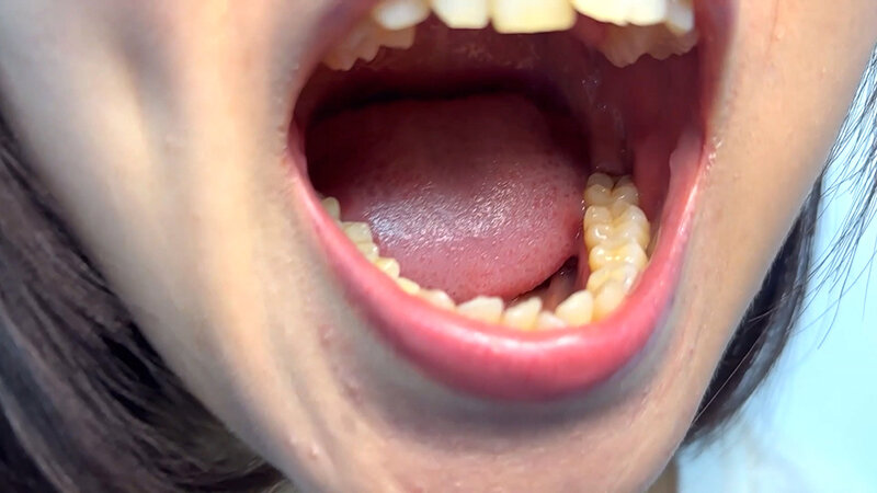 「【素人ナンパ】街角お姉さんみゆりちゃんの口内観察！テレビ局AD美女が恥じらい体験」のサンプル画像5枚目